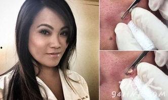 挤痘痘和挤黑头的视频,视频教学与注意事项