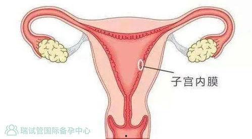 试管婴儿移植视频,科技助力生命延续